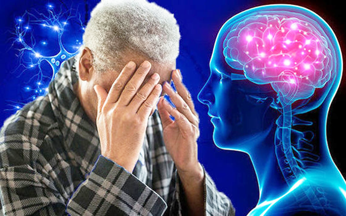 Tỷ lệ bệnh Alzheimer